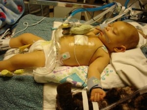 Chloe, Hospital and party 112 Small baby in a hospital bed who is post heart surgery and hooked up to medical monitors.